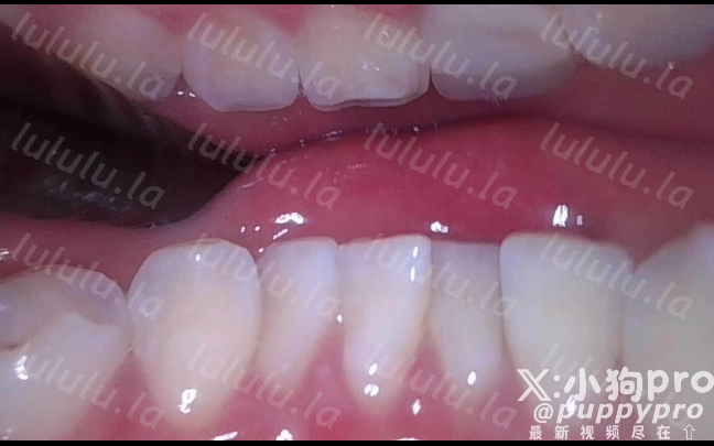 极品嫩妹-puppypro（小狗pro）-新付费福利小合集（2V,382M）-福利岛
