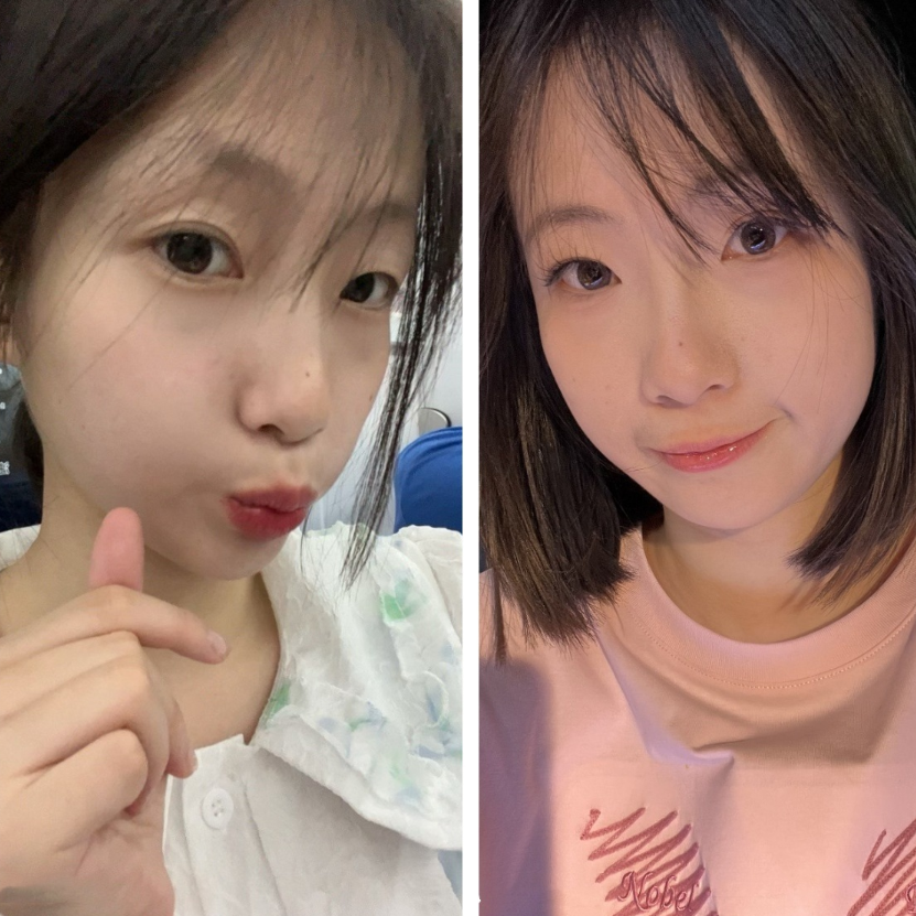 2025年6月最新，【极品泄密】，舞蹈系美女大学生，完美露脸，小穴超进展，每次操的时候一脸痛苦，奶子很漂亮！[2V980M